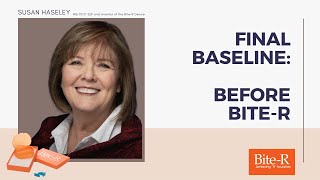 Final Baseline: Before Bite-R