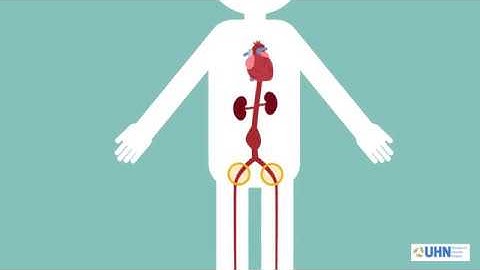 EVAR 2- What is Endovascular Aneurysm repair?