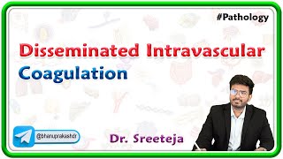 12. Disseminated Intravascular Coagulation (DIC) | USMLE Step 1 Pathology