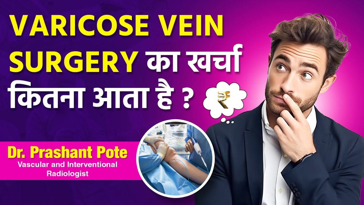 cost-of-varicose-veins-treatment-in-india-with-actual-rates-by-dr