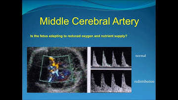 Obstetric Doppler Part 2