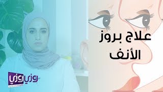 علاج عظمة الأنف البارزة