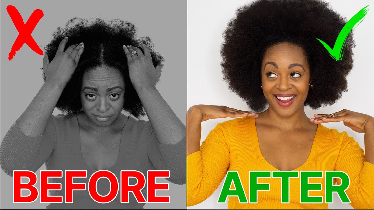 DRY, ITCHY SCALP? Cure it FAST | 4C Natural Hair - YouTube