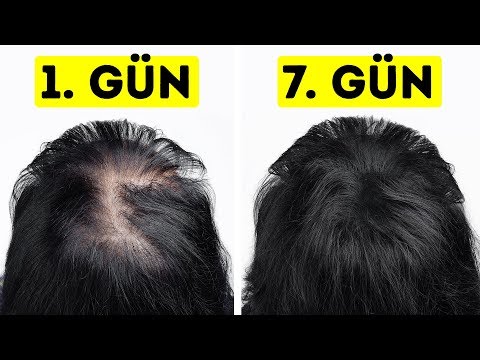 Video: Kuru Saçları Artırmak İçin Jojoba Yağı Nasıl Kullanılır: 8 Adım (Resimlerle)