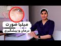 میلیا صورت متخصص پوست توضیح میده
