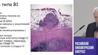 Аспекты патоморфологической диагностики опухолей тимуса