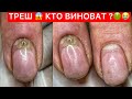 ПАНАРИЦИЙ😱ЧТО СЛУЧИЛОСЬ ?😭 СВЕТООТРАЖАЮЩИЙ МАНИКЮР 😍✨