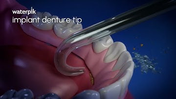 Waterpik™ Implant Denture Tip
