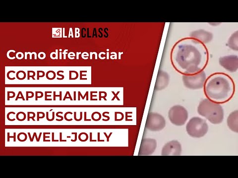 Vídeo: Quando você vê corpos pappenheimer?