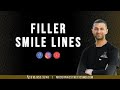 Filler smile lines  modern aesthetics  dr anwar md