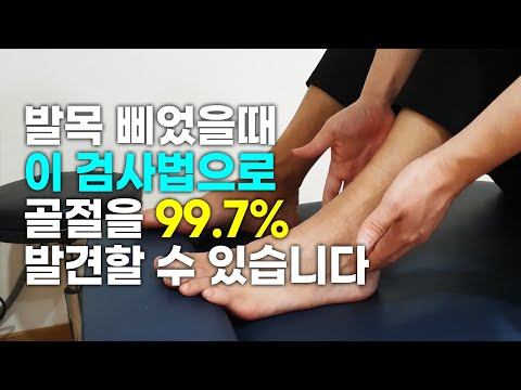 발목 삐었을때 골절과 인대손상을 쉽게 확인하는 검사법 (발목 염좌, 발목 접질렀을때, 발목 인대 늘어났을때)