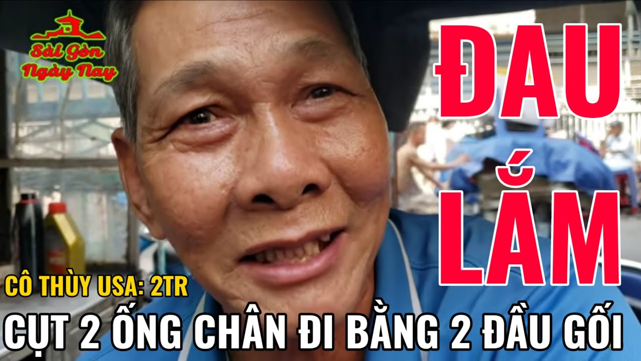 Cụt 2 Ống Chân Đi Bằng Đầu Gối Đau Lắm | Gởi 2Tr Cô Thùy Usa Tặng Chú Bình  Tpb Bán Vé Số Ở Saigon - Youtube