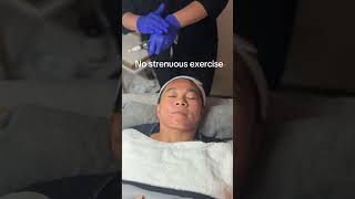 What to Do After a Microneedling Treatment? ✨