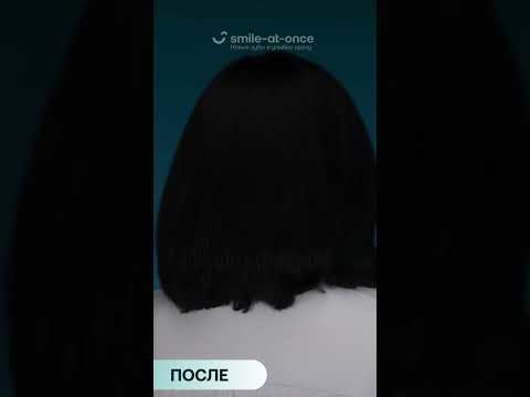 «Раньше заглядывали мне в рот: «Господи, что там творится». Сейчас все видят, какая красивая улыбка»