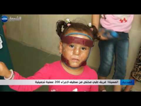 المسيلة فريق طبي مختص من سطيف لإجراء 200 عملية تجميلية