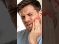 mouth blisters | munh k chaley #healthvideo #healthbestvideo #ytshorts #stomatitis #foryou #viral