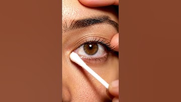 “Deep Pore Pimple Popping on over-eye – So Satisfying!”