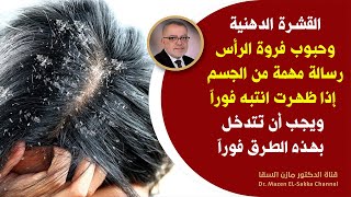 إذا لاحظت ظهور حبوب فروة الرأس فجأة والقشرة الدهنية فهي رسالة مهمة من الجسم انتبهوا وتدخلوا فوراً