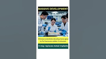 Chinese scientists develop bone glue to fix fractures within 3 minutes. #tothebone #crackingbones