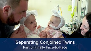 Separating Conjoined Twins Part 5: Finally Face-to-Face