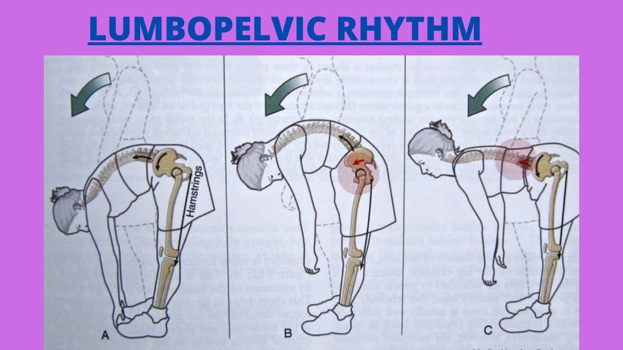 What Is Lumbopelvic Rhythm In Hip Lumbopelvic Rhythm Pelvifemoral
