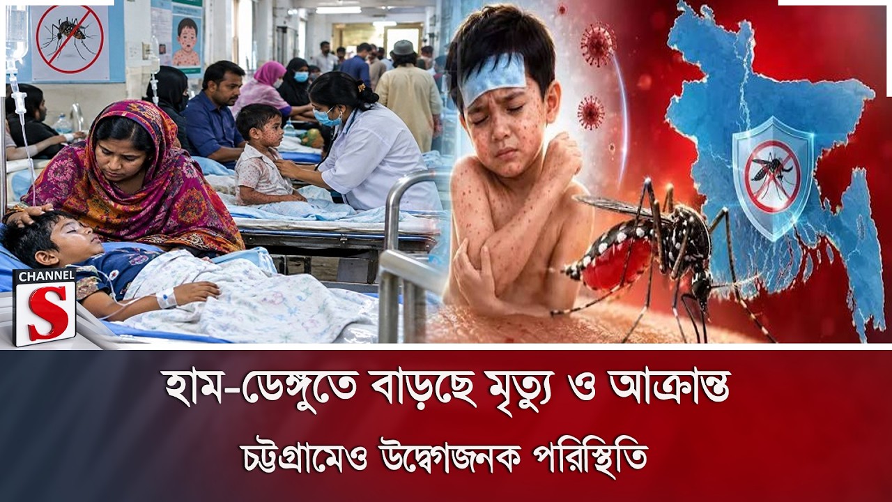 হাম-ডেঙ্গুতে বাড়ছে মৃ/ত্যু ও আক্রান্ত; চট্টগ্রামেও উদ্বেগজনক পরিস্থিতি | Channel S News