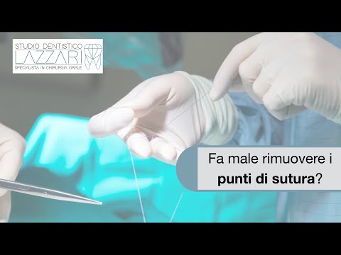 Video: La rimozione della sutura fa male?