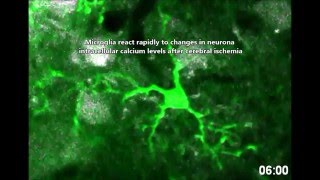 Microglia protect against brain injury and their selective elimination dysregulates neuronal network