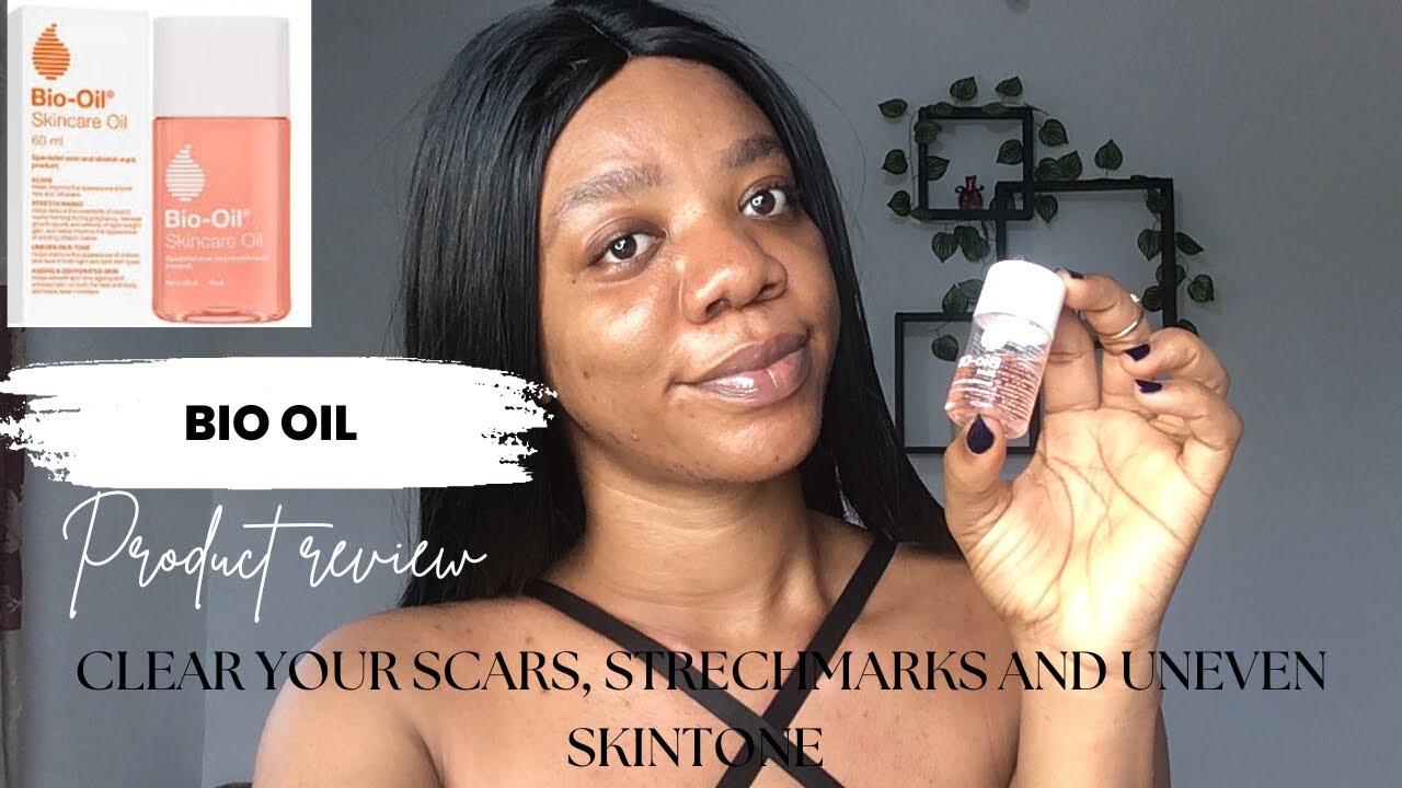 frequentie merk exotisch Bio oil product review | for uneven skin tone, scars and stretch marks -  YouTube