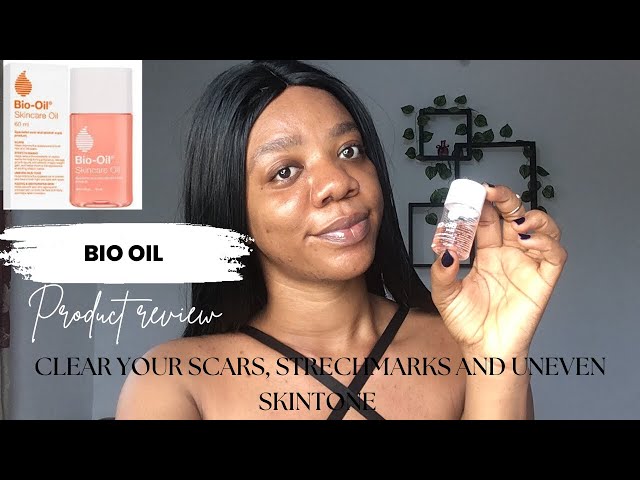 Bio oil product review  for uneven skin tone, scars and stretch