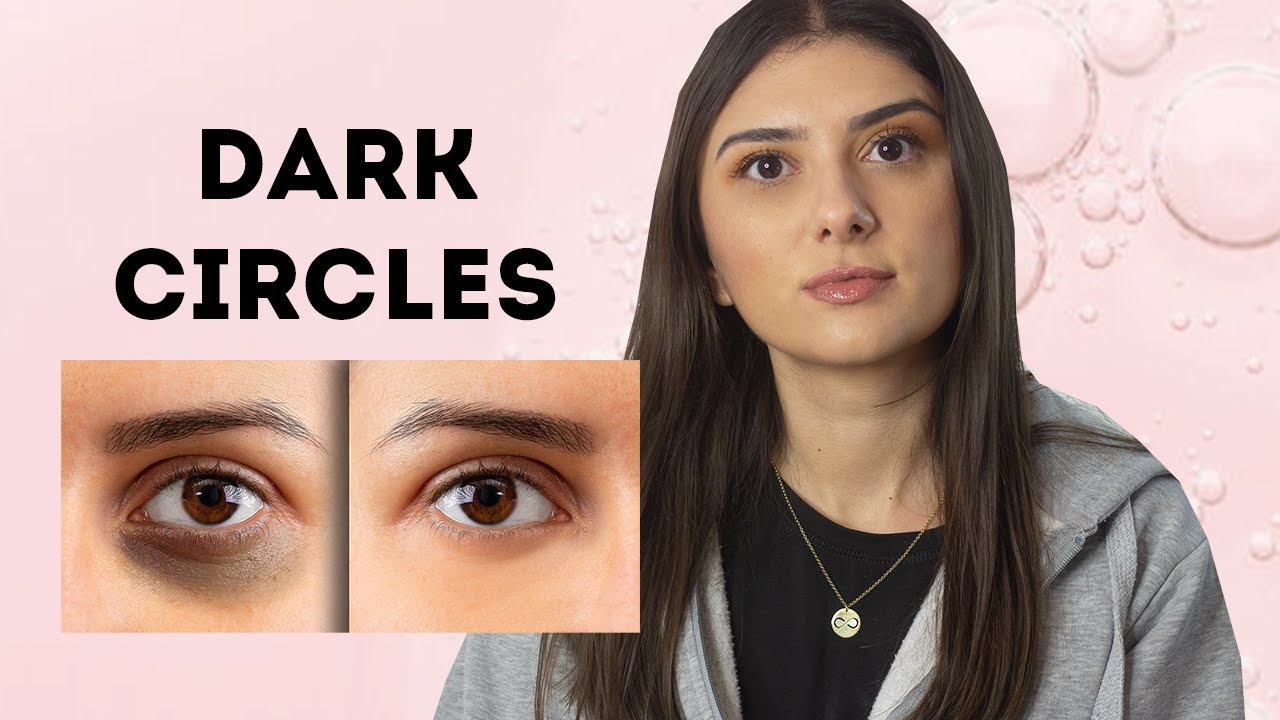 Μαύροι κύκλοι κάτω από τα μάτια | Πως αντιμετωπίζονται | Olga