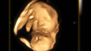 Echo 3d Passion Echographie Affective 3d 4d A Lille Decouverte Du Sexe Du Bebe E 3d Youtube