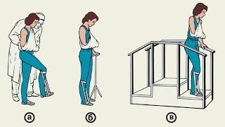 Ходьба по лестнице после инсульта, как правильно и с чего начать.