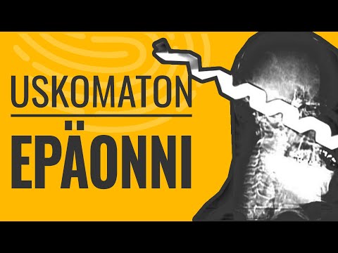 Video: 3 tapaa pysäyttää ikenen taantuma