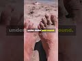 How to Fix Ugly Toenails with 2 Simple Kitchen Hacks! #shorts #fungustreatment #ahealthylife7038