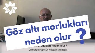 Göz altı morlukları neden olur?
