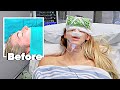 She Got A Nose Job *Surgery Day*