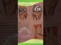 آناتومی مفصل زانو زانو از چه اجزاي تشکیل شده ورزش بدن سلامتی