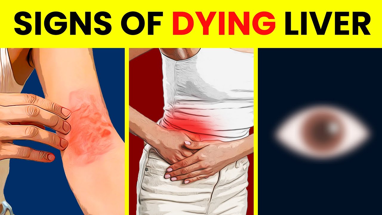 8 IMPORTANT Signs Your LIVER IS IN DANGER - YouTube