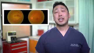 Oklusi Arteri Retina Sentral dan Pijat Mata