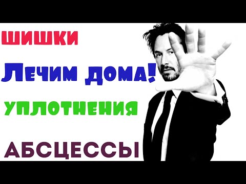 Как и чем лечить уплотнения, шишки, инфильтраты после уколов и инъекций. Без операции.