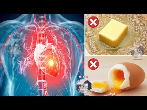 Video: A kanë karkaleca të larta në kolesterol?