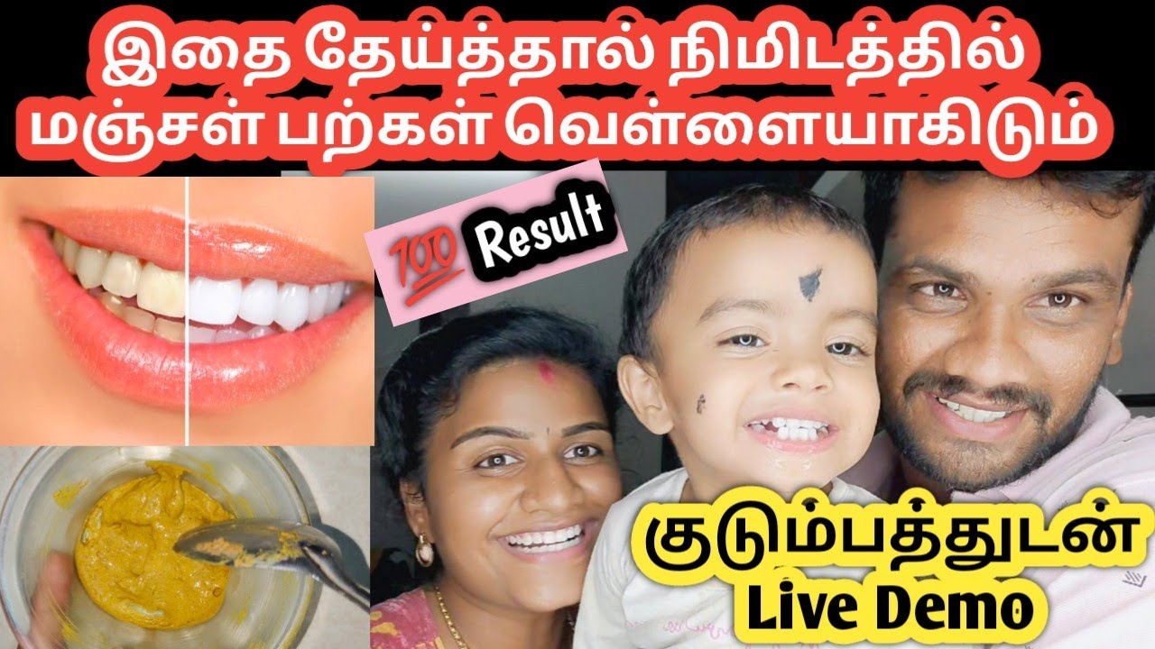how to whiten teeth at home in tamil/மஞ்சள் பற்கள் வெள்ளையாக/teeth