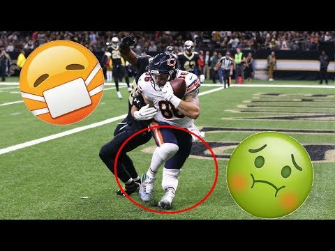 Worst Football Injuries (Part 2) (GRUESOME)