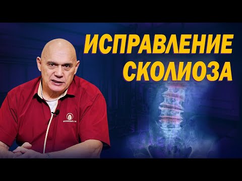 Что такое сколиоз и почему он возникает? Исправление искривления позвоночника и остеохондроза