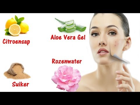 Video: 3 manieren om acnelittekens te behandelen met aloë vera