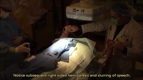 WADA Test (Intracarotid Methohexital Test)