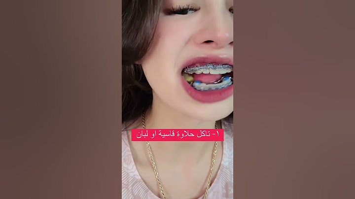 3 عادات لازم توقفها مع التقويم😅🦷