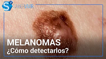 ¿Cuál es el mejor indicador del pronóstico de un melanoma?