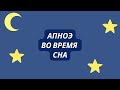 Апноэ во время сна, определение, патогенез, симптомы, диагностика, лечение